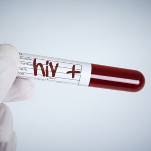 test tube labeled HIV+